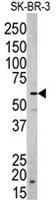 PAB4805 - Neuregulin 1