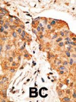 PAB4805 - Neuregulin 1