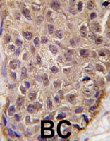 PAB4810 - OAS1 / OIAS
