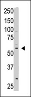 PAB4813 - CREB3L1 / OASIS