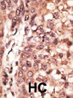 PAB4813 - CREB3L1 / OASIS