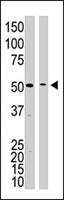 PAB4815 - Presenilin-1
