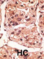 PAB4815 - Presenilin-1