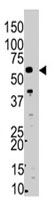 PAB4818 - SMYD5