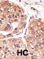 PAB4818 - SMYD5