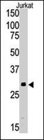 PAB4825 - SIRT5