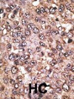 PAB4825 - SIRT5