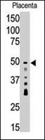 PAB4826 - SIRT7