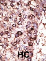 PAB4826 - SIRT7