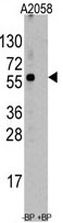 PAB4827 - ST13 / HIP