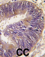 PAB4827 - ST13 / HIP