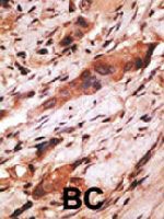 PAB4830 - CD82