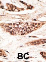 PAB4832 - ABCB2 / APT1 / TAP1