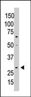 PAB4836 - WISP2