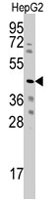 PAB4837 - WISP3