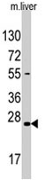 PAB4841 - Sclerostin / SOST