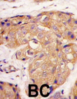 PAB4841 - Sclerostin / SOST