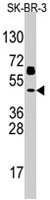 PAB4845 - TP53 / p53