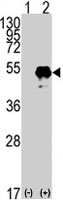 PAB4846 - TP53 / p53