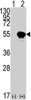 PAB4847 - TP53 / p53