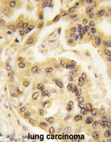 PAB4850 - TP53 / p53