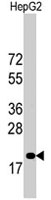 PAB4851 - CDKN1B / KIP1