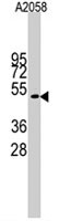 PAB4852 - Cyclin E1