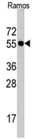 PAB4853 - CDC6