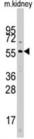 PAB4854 - CDC25A