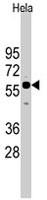 PAB4855 - CDC25A