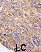 PAB4858 - TOB2