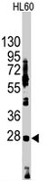 PAB4860 - HES1