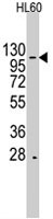 PAB4861 - HIRA / TUPLE1