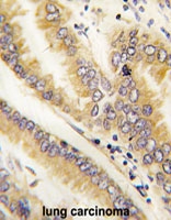 PAB4864 - AGR2