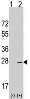 PAB4864 - AGR2