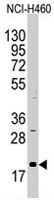 PAB4865 - AGR2