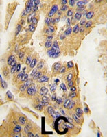 PAB4865 - AGR2