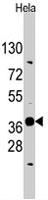 PAB4866 - Ectodysplasin-A