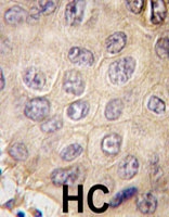 PAB4866 - Ectodysplasin-A