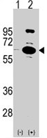 PAB4872 - PARP6
