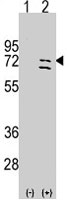 PAB4873 - PARP6