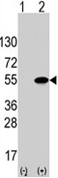 PAB4874 - ATF4