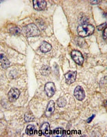 PAB4880 - CD14