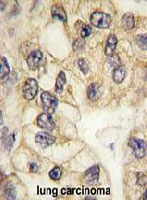 PAB4881 - CD14