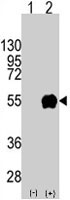 PAB4881 - CD14