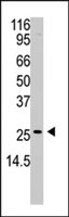 PAB4887 - APH1A
