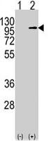 PAB4898 - Amyloid beta A4 protein / APP