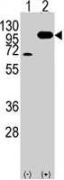 PAB4899 - Amyloid beta A4 protein / APP