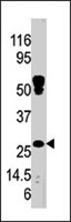 PAB4902 - HSD17B10 / ERAB