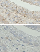 PAB4902 - HSD17B10 / ERAB